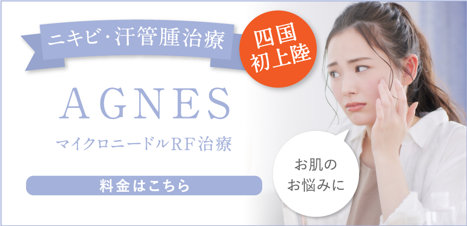 AGNES