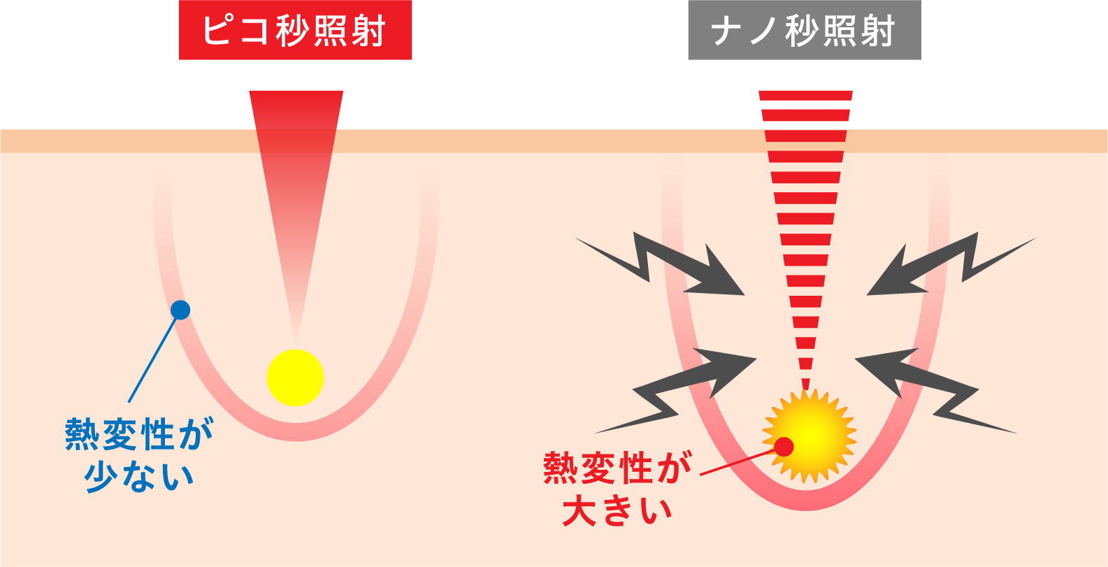 ディスカバリーピコプラス