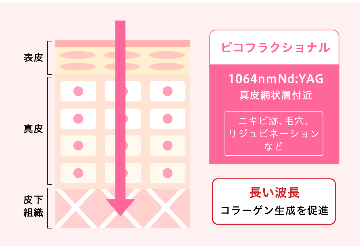 ディスカバリーピコプラス